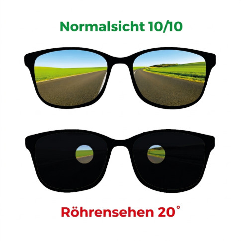 Brille zur Simulation eines 20°-Tunnelblicks