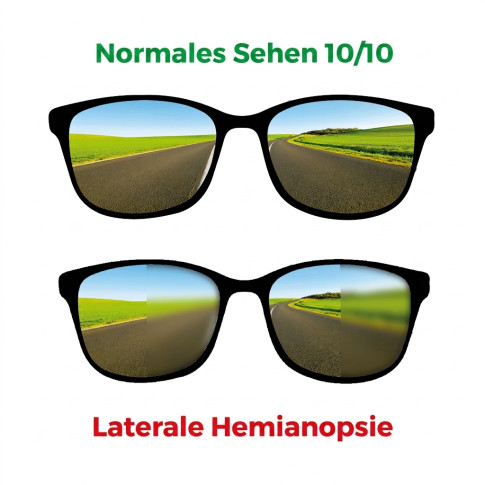 Brille zur Simulation einer lateralen Hemianopsie