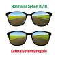 Brille zur Simulation einer lateralen Hemianopsie